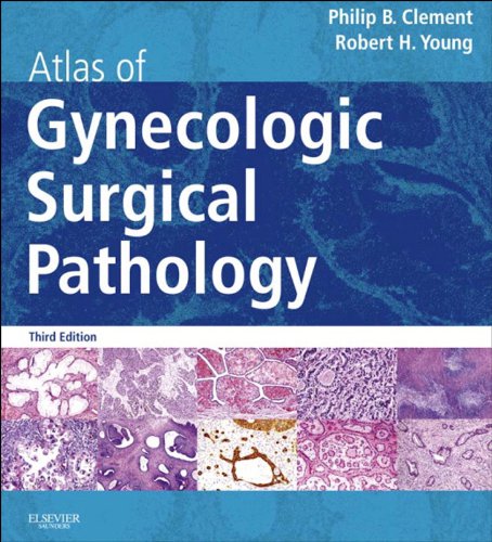 Atlas of Gynecologic Surgical Pathology: Expert Consult: Online (Atlases in  Diagnostic Surgical Pathology) (English Edition)