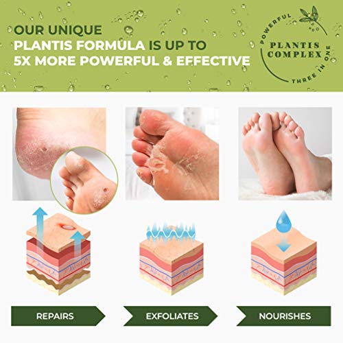 Plantifique – Mascarilla Exfoliante Pies - 2 pares para pelar los callos y durezas de pies - Elimina piel muerta y seca - Baby feet peel en 7 días, calcetines exfoliantes de pies - Foot Peeling Mask