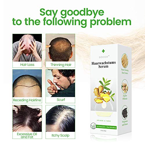 Serum de Crecimiento del Cabello con Esencia de Jengibre para Anticaida de Cabello y Crece Pelo, Nutrir los Folículo Piloso de hombres y mujeres para el Crece Rápido y Completo del Cabello