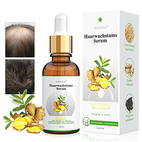 Serum de Crecimiento del Cabello con Esencia de Jengibre para Anticaida de Cabello y Crece Pelo, Nutrir los Folículo Piloso de hombres y mujeres para el Crece Rápido y Completo del Cabello