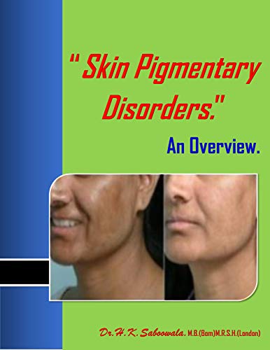 “Skin Pigmentary Disorders: An Overview.” (English Edition)