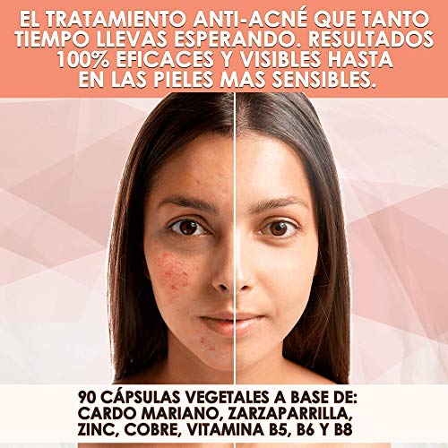 STOP ACNÉ | Elimina el Acné y Previene su Aparición | Tratamiento Eficaz Contra Espinillas y Puntos Negros Grasos | Cardio Mariano + Zarzaparrilla + Zinc + Cobre + Vit. B5, B6, B8 | 90 caps. vegetales