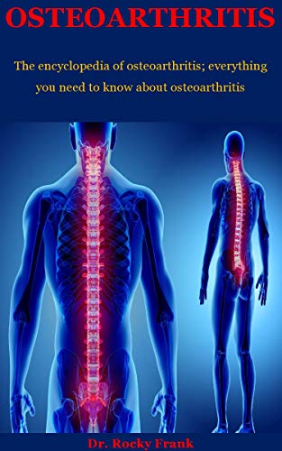 Osteoarthritis: The encyclopedia of osteoarthritis; everything you need to know about osteoarthritis (English Edition)