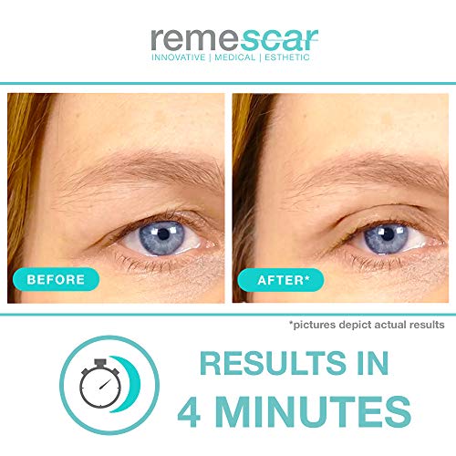 Remescar - Párpados caídos - Crema de efecto lifting para reducir las bolsas - Crema de ojos antienvejecimiento probada clínicamente para hombre y mujer - Relleno reafirmante para los ojos