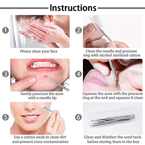 5 Piezas de herramientas (Conjunto) para eliminar espinillas, Extractor de acné, Herramienta (con caja) de eliminar acné, espinilla, mancha y pápula