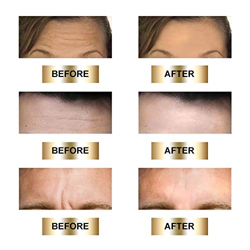 Facial Patches, Parches Faciales Antiarrugas, Parches Antiarrugas, Anti-Arrugas Parches, Antiarrugas Frente para hombres y mujeres, elimina las arrugas de cejas,10 PCS