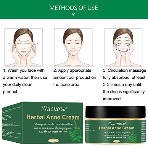 Crema Antiacne, Acné Crema, Acne Tratamiento, Reducir los Puntos negros, Acne Cream, Equilibrar el Agua y el Aceite, la Crema Contra el Acné Espinilla Regenera la piel, 100 g