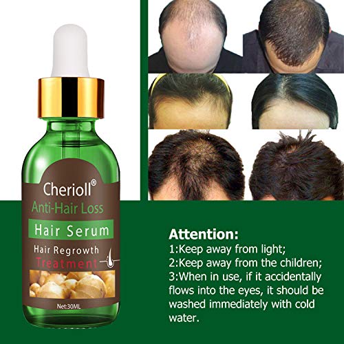 Serum Pelo, Hair Serum, Serum Cabello, Hair Growth Serum, Crecimiento Cabello Serum, Anti Caida Cabello, Caida Cabello Hombre - Promueve Crecimiento Pelo Completo ＆ Más Rápido