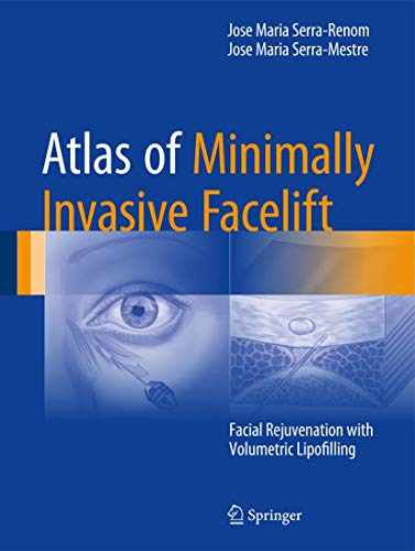 Atlas of Minimally Invasive Facelift: Facial Rejuvenation with Volumetric Lipofilling