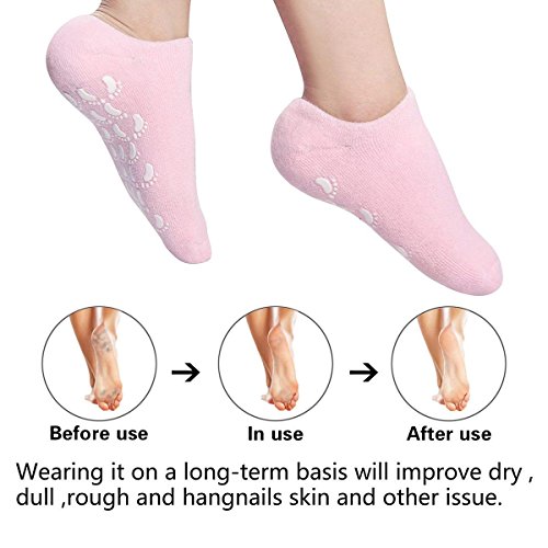 Calcetines hidratantes, calcetines de gel hidratante ultra suave, para reparar y suavizar las pieles secas y agrietadas, forro de gel con aceites esenciales y vitaminas (2 pares de azul y rosa)