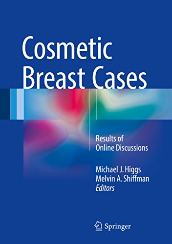 Cosmetic Breast Cases: Results of Online Discussions (English Edition)