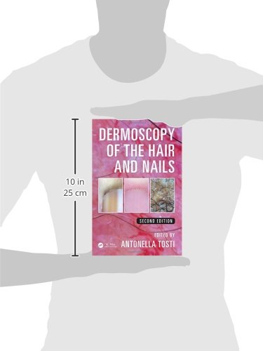 Dermoscopy of the Hair and Nails