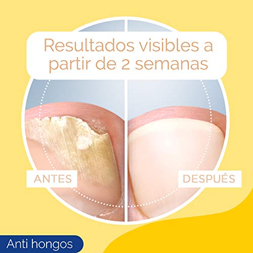 Scholl Tratamiento Anti Hongos 3.8 ml + Crema de Pies para Durezas 60ml