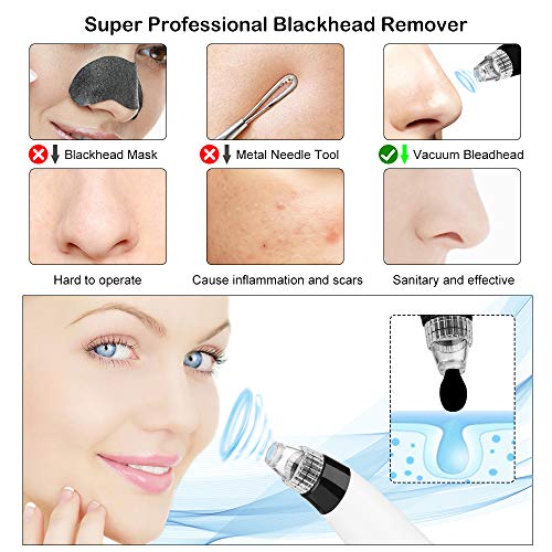 SVMUU Limpiador de Poros Extractor Puntos Negro Limpiador Facial Eléctrico Blackhead Recargable con USB con 4 Cabezales y 5 Nivel de Potencia para Espinillas y Acné Adecuado para Hombres y Mujeres