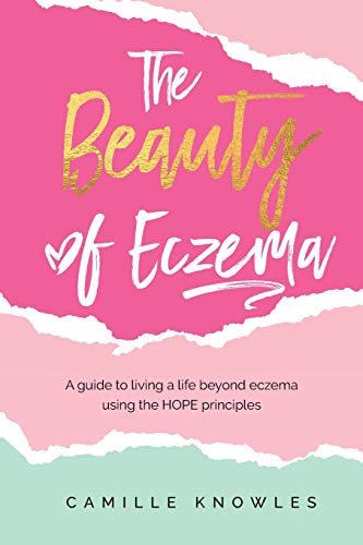 The Beauty of Eczema: A Guide To Living a Life Beyond Eczema Using The Hope Principles