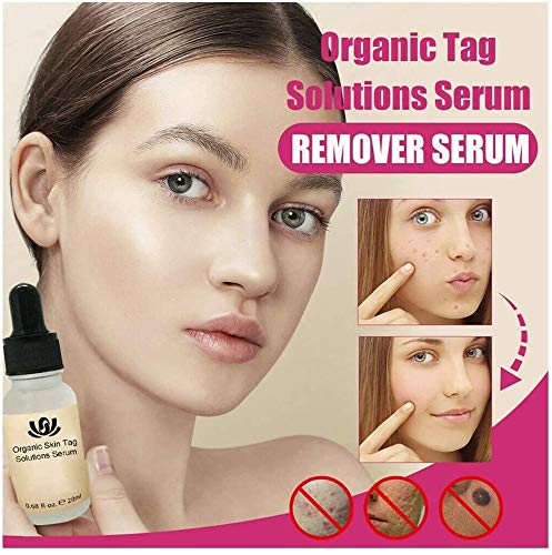 TTCPUYSA 2pcs Organic Tags Solutions Serum,Mole and Skin Tag Remover and Repair Cream Oil, Effectively Remove Freckle Pigmented/Melanin Spots/Face Wart Tag