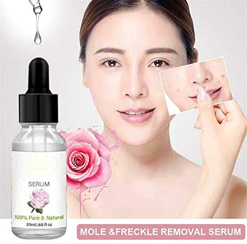 TTCPUYSA Organic Skin Spot Purifying Serum All Natural Tags Free Mole & Tag Removal Dark Spot Corrector Serum (2 pcs)