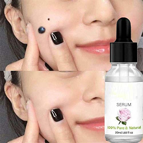 TTCPUYSA Organic Skin Spot Purifying Serum All Natural Tags Free Mole & Tag Removal Dark Spot Corrector Serum (2 pcs)