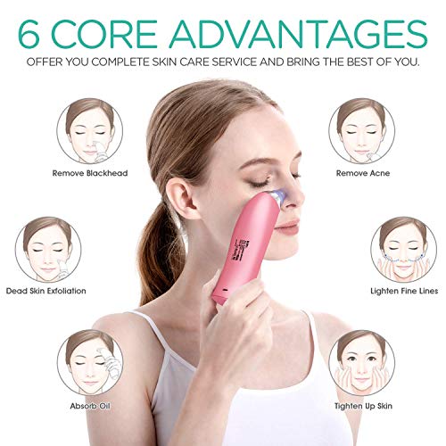 Umi. Blackhead Remover Vacuum Suction Facial Pore Cleaner Electric Acne Comedone Extractor Kit with 4 Replacement Head & LCD Screen for Women and Men Black Heads Extraction (Pink)