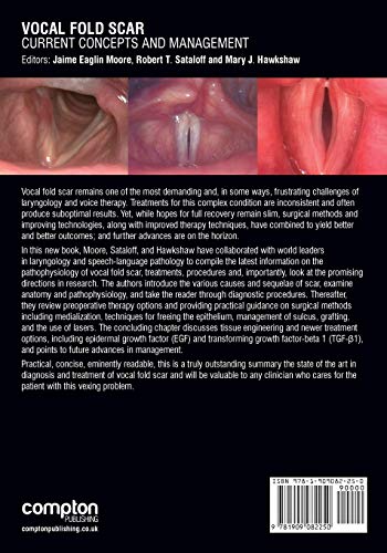 Vocal Fold Scar: Current Concepts and Management