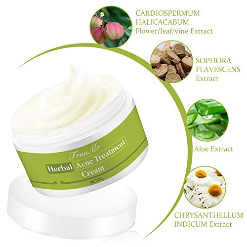 Crema Antiacne, Acné Crema, Acne Tratamiento, Anti Acne, Acné Suavemente Suficiente Para Pieles Sensibles, Hombres, Mujeres – Ayuda a Eliminar el Equilibrar Cara Agua y Aceite, Acné Fosos de Reparar