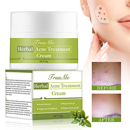 Crema Antiacne, Acné Crema, Acne Tratamiento, Anti Acne, Acné Suavemente Suficiente Para Pieles Sensibles, Hombres, Mujeres – Ayuda a Eliminar el Equilibrar Cara Agua y Aceite, Acné Fosos de Reparar