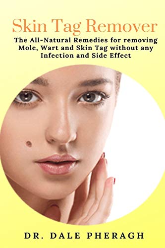 Skin Tag Remover: The All-Natural Remedies for removing Mole, Wart and Skin Tag without any Infection and Side Effect