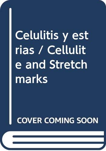 Celulitis y estrias / Cellulite and Stretch marks