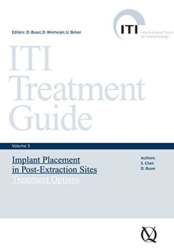 ITI Treatment Guide: Implant Placement in Post-extraction Sites: Treatment Options 3 (ITI Treatment Guides)