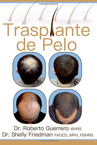 Trasplante De Pelo