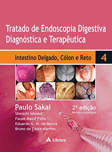 Tratado de Endoscopia Digestiva -  Intestino Delgado, Cólon e Reto - Volume 4 - 2ª Edição (Portuguese Edition)