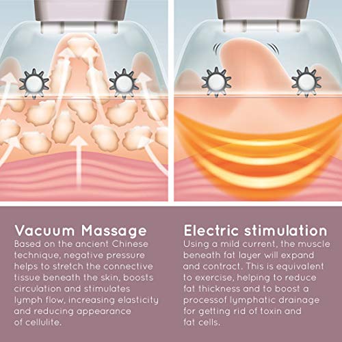 HoMedics Smoothee Masajeador Anticelulítico de Vacío Intercambiables, Tratamiento Suavizante Contra la Celulitis, Desintoxica la Piel, Activa el Metabolismo, Recargable