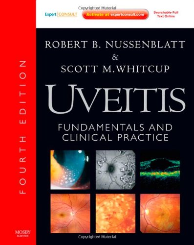 Uveitis: Fundamentals and Clinical Practice: Expert Consult - Online and Print, 4e