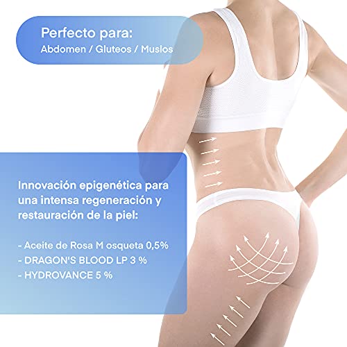 Crema antiestrias ideal para el embarazo/Previene y Reduce la formación estrías y cicatrices/Gel con Rosa Mosqueta regeneradora anti-estrias postparto