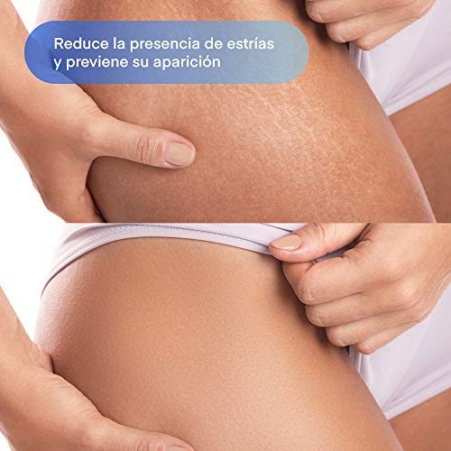 Crema antiestrias ideal para el embarazo/Previene y Reduce la formación estrías y cicatrices/Gel con Rosa Mosqueta regeneradora anti-estrias postparto