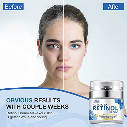 Crema de Retinol para Rostro, Hidratante Facial con Colágeno y Ácido Hialurónico, Crema Hidratante Antiarrugas para Mujer y Hombre, Crema Antiedad de Día y Noche, para Todo Tipo de Piel