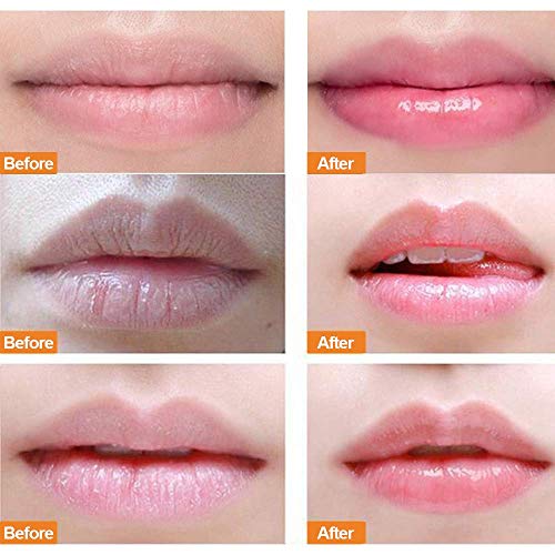 Máscara de Labios,con Exfoliantes e Hidratantes para Labios,Elimina Eficazmente la Piel Muerta y Tratamiento Intensivo de Reparación de Labios, Hidratante Nutritivo