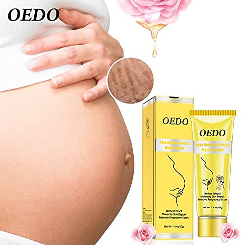 OEDO Crema para eliminar estrías embarazo, nutrición hidratación, antiarrugas, de la piel Reparación,