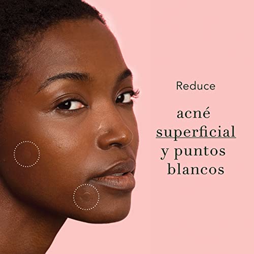 Rael parche de tratamiento facial antiacné – invisible, absorbe las imperfecciones, con hidrocoloide, de dos tamaños: 10 mm y 12 mm (96 unidades)