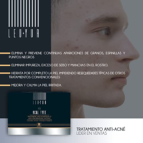 Tratamiento Anti-Acné | Elimina por completo granos, espinillas y puntos Negros | Rostro limpio y perfecto | Protege la salud de la Piel | Colágeno, Cardio Mariano, Zarzaparrilla, Aloe Vera | 100 Caps