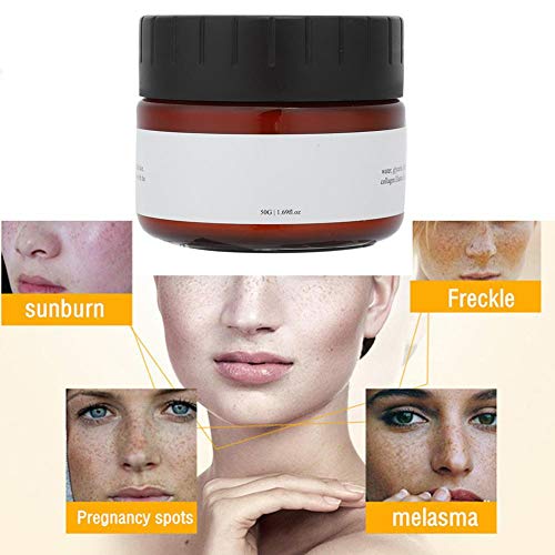 50g Crema para eliminar las pecas, crema hidratante aclaradora para aclarar las manchas faciales de la piel Manchas para quemaduras solares Eliminar la crema