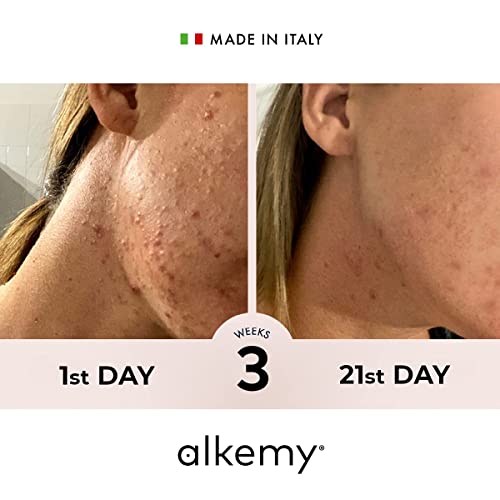 ALKEMY Crema Antiacné e Imperfecciones – Cosmética Natural – Tratamiento Acné Dermatológicamente Testado – Fuerte acción Calmante con efecto Purificante – PURIFYNG FACE CREAM