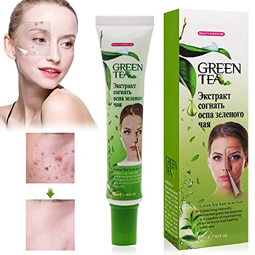 Crema Antiacne, Anti Acne, Acne Tratamiento, Acné Crema, Balance Facial Agua Y Aceite, Acné Reparador De Fosas, Crema Anti-Acné Acné Para Regenerar La Piel