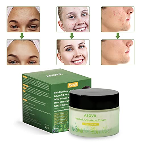 Crema Antiacne Para el Rejuvenecimiento de la Piel, Acné Crema Removedor de Puntos Negros, Crema Antimanchas Facial a base de Hierbas,Anti Acne, Equilibrio de Agua y Aceite,Acne Tratamiento, 50g