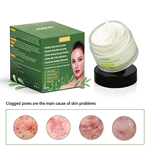 Crema Antiacne Para el Rejuvenecimiento de la Piel, Acné Crema Removedor de Puntos Negros, Crema Antimanchas Facial a base de Hierbas,Anti Acne, Equilibrio de Agua y Aceite,Acne Tratamiento, 50g