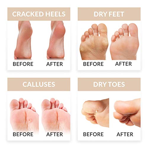 Exfoliante pies quita callos pies calcetines exfoliantes de pies mascarilla pies peeling babyfoot baby foot elimina callos, 2 pares (hasta la talla 43)