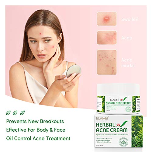 Herbal Acne Cream, Crema Antiespinillas, Crema Antiacné, Acné Tratamiento, Equilibrar el Agua y el Aceite, Elimina las Manchas de la Piel, Efectivo para Cuerpo y Rostro - 50g