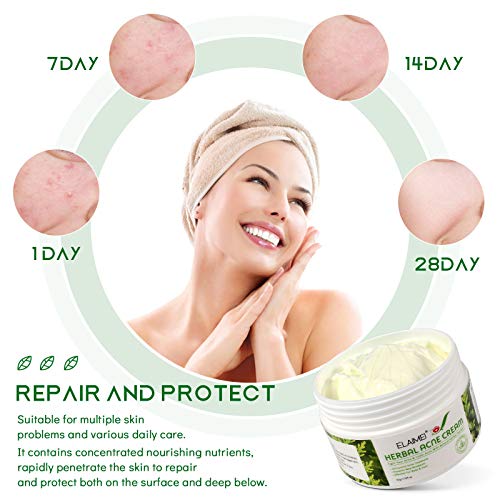 Herbal Acne Cream, Crema Antiespinillas, Crema Antiacné, Acné Tratamiento, Equilibrar el Agua y el Aceite, Elimina las Manchas de la Piel, Efectivo para Cuerpo y Rostro - 50g