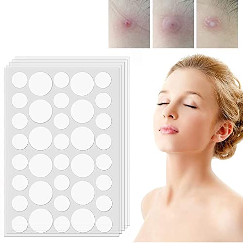 ILamourCar Parches Para Acné, Parches para Granos, 180 Piezas Hydrocolloid Patches Invisibles de 8/12 mm, para el Tratamiento del Acné Facial