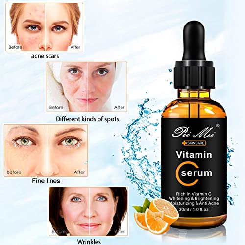 Sérum Facial con Vitamina C, Suero Facial, Suero Antiedad, Antiarrugas y Antimanchas, con Vitamina C, ácido hialurónico Suero para Rostro, Cuello,30ML